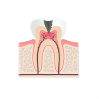 Periodontal-(Gum)-Care